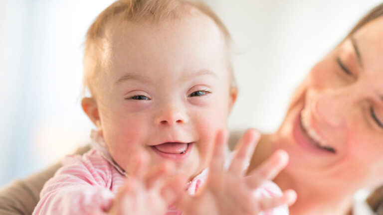 Lee más sobre el artículo Síndrome de Down: Comunicar la noticia, el primer acto terapéutico